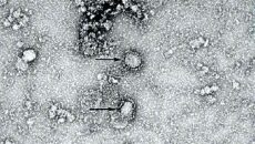 Число жертв коронавируса в мире превысило 10 тыс. человек