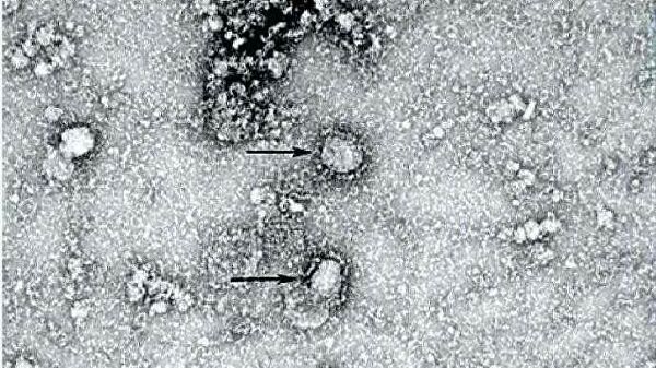 В США зафиксирована первая смерть от коронавируса