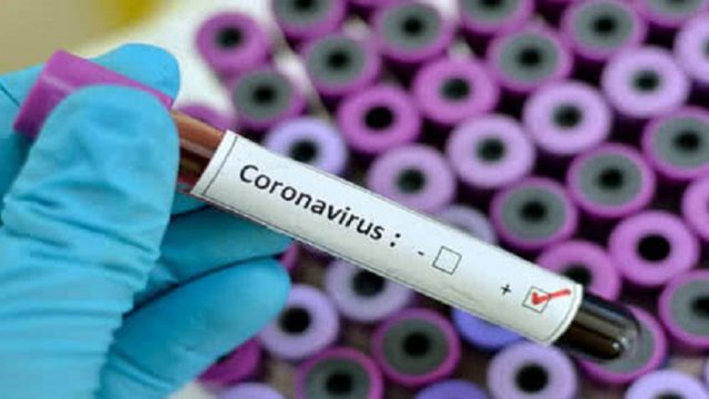 В Украину поступили высокоточные корейские тест-системы для диагностики коронавируса
