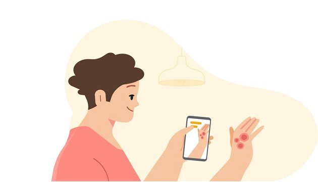 Google представил приложение для обнаружения заболевания кожи